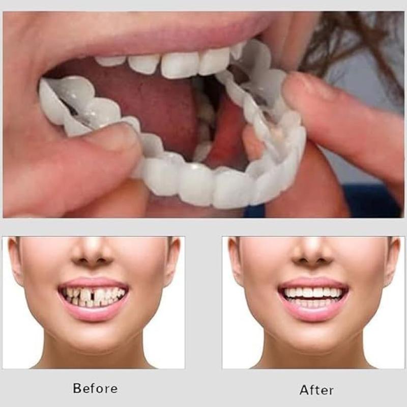 Snap On Smile  Veneers Teeth For Men And Women  Moldable False Artificial Braces Teeth Kits